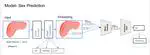 Graph Neural Networks on Abdominal Organs